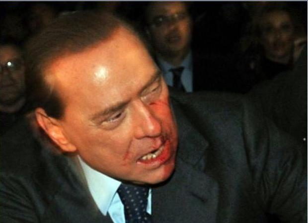Aggressione Silvio Berlusconi